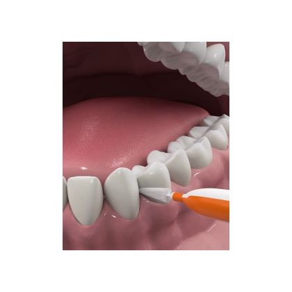 DenTek Удобное очищение Межзубные щетки для Стандартных промежутков, 16 шт. в Стоматологии «Дента.UA»