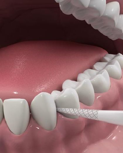 Флосс-зубочистки тройное очищение DenTek, 90 шт. в Стоматологии «Дента.UA»