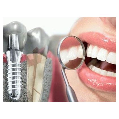 Dentium implant installation operation (South Korea)