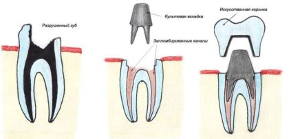 The cult tab is lined with ceramics in «Denta.UA»