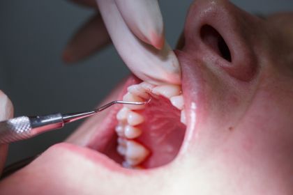 VEKTOR therapy of the upper and lower jaw in «Denta.UA»