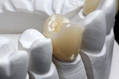 Temporary crown RMMA in «Denta.UA»