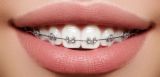 Initial consultation of a dentist-orthodontist (overview, panoramic shot, photo report) in «Denta.UA»