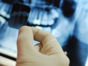 Консультация стоматолога и скорая помощь